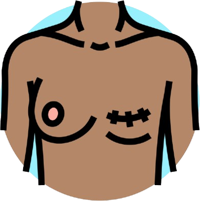 Surgery Types